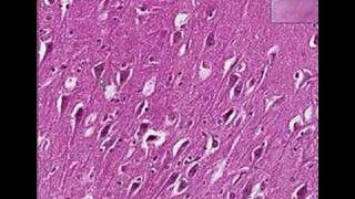 Histopathology Brain--Rabies