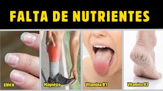 20 SINAIS E SINTOMAS DE FALTA DE NUTRIENTES IMPORTANTES (VITAMINAS E MINERAIS) Dr Alain Dutra