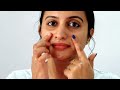 how to remove darkspot u0026pigmentation best cream for pigmentation blemishes and dark spots dermatouch