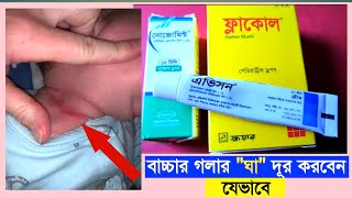 Baby Neck Infection | বাচ্চার গলার নিচে ঘা বা চুলকানি, নাক আটকে গেলে, পেটে ব্যথা হলে যে ঔষধ গুলো