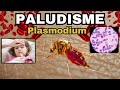 Tout savoir sur le PALUDISME - MALARIA : Plasmodium, Cycle, Diagnostic, Traitement