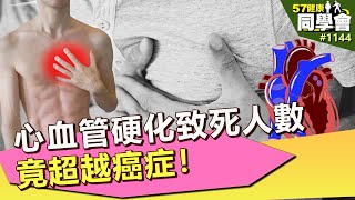 驚！心血管硬化致死人數 超越癌症【57健康同學會】第1144集 2014年