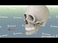 3d프린팅기술을 활용한 광대재수술 광대재건 광대복원수술 3d fit 임플레이트 수술기법 티타늄 pcl tcp