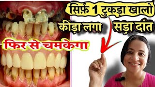 सिर्फ एक टुकड़ा खालो कीड़ा लगा दांत फिर से चमक उठेगा / Tooth Cavity