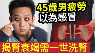 『必睇』遲早關你事！45歲男「感覺疲勞」冇胃口食嘢「以為感冒」睇醫生證實「患腎衰竭！」需要「一世洗腎！」醫生列「10大常見症狀！」教你避免「五大傷腎」方法！(shorts)蔡天鳳