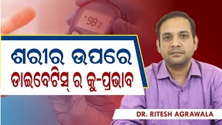 Diabetes Side Effects on Body |ଶରୀର ଉପରେ ଡାଇବେଟିସ୍ ର କୁ-ପ୍ରଭାବ |  Complications Of Diabetes in Odia