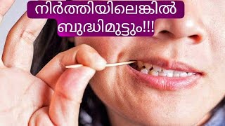 ഇത് നിർത്തിയിലെങ്കിൽ ബുദ്ധിമുട്ടും / teeth/ dental tips malayalam/ toothpick / pallu vedhana/ pallu