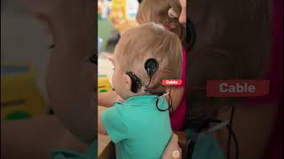 Visual Guide to Cochlear Implants | Meet the Cochlear Implant