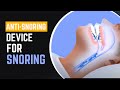 Anti-Snoring Device For Snoring | Stop Snoring Mouthpiece By Vital Sleep