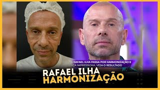 Rafael Ilha faz harmonização facial e resultado choca