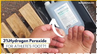 Hydrogen Peroxide (3%) Foot Soak to get rid of ATHLETE'S FOOT (Does It Work?)