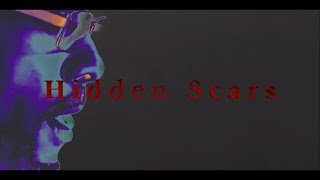 Kase The Artistic One - Hidden Scars (Official Video)