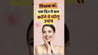 Pimple home remedies: फोड़े फुंसियों एक दिन में कम करेंगे ये घरेलू उपाय #shorts #ytshorts