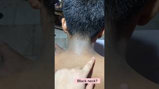 Black Neck Solution #Shorts #skincare