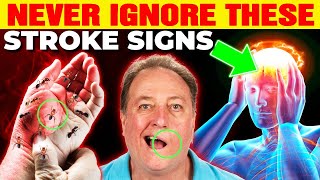 9 Silent Stroke Signs You Should Never Ignore!