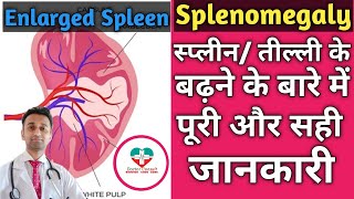 Splenomegaly। Speen/ प्लीहा/ तील्ली के बारे में पूरी जानकारी। Causes,Types,Treatment Of Splenomgaly