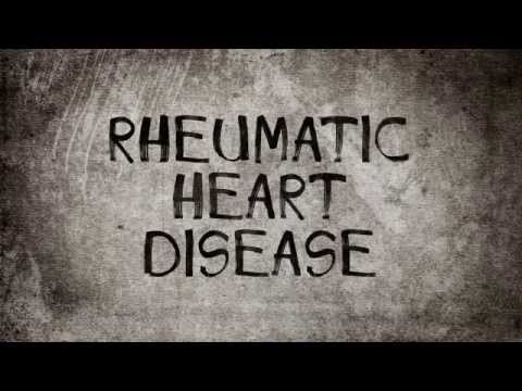 Strep Throat to Rheumatic Heart Disease Strep Throat to Rheumatic Heart Disease