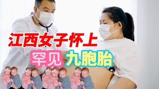 罕見！江西南昌一女子懷上九胞胎！九個孕囊都有心脈！為保母體安全會不會減胎？