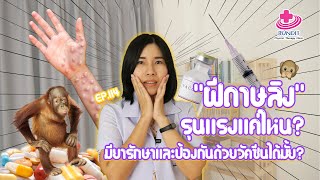 ฝีดาษลิง รุนแรงแค่ไหน มียารักษา หรือมีวัคซีนป้องกันหรือไม่?? | หมอยามาตอบ EP.114