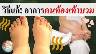 การดูแลคนท้อง : วิธีแก้อาการ คนท้องเท้าบวม!!! | ดูแลตัวเองตอนท้อง | คนท้อง Everything