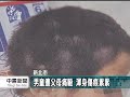 20110614 公視中晝新聞 男童作業未寫完 遭父母痛毆兩天.mpg