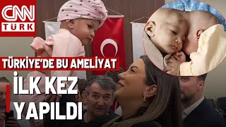 Türk Doktorlar Kafadan Yapışık İkizleri Ayırdı! 2,5 Milyonda Bir Görülen Vaka!