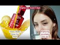 darkspots luiza s brighter skin journey with aprilskin