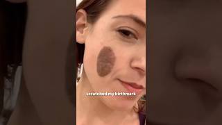 Would you have said anything? #jokes #standupcomedy #weird #cat #birthmark #mole