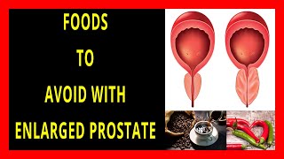 Foods to Avoid if You Have an Enlarged Prostate | Reduce Symptoms, Enlargement and Cancer