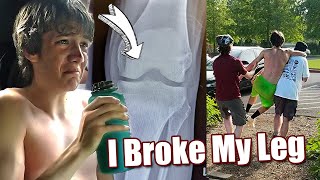 I Broke My Leg! 😱🤕