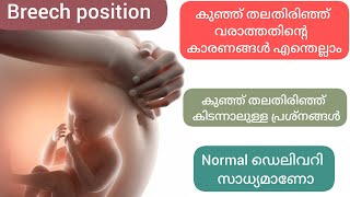 കുഞ്ഞ് തലതിരിഞ്ഞ് കിടക്കാനുള്ള കാരണം എന്ത്? അതുകൊണ്ടുള്ള  പ്രശ്നങ്ങൾ / Breech position  explained