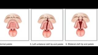 TERATOLOGI  _Pengembangan Ilmu Bilologi