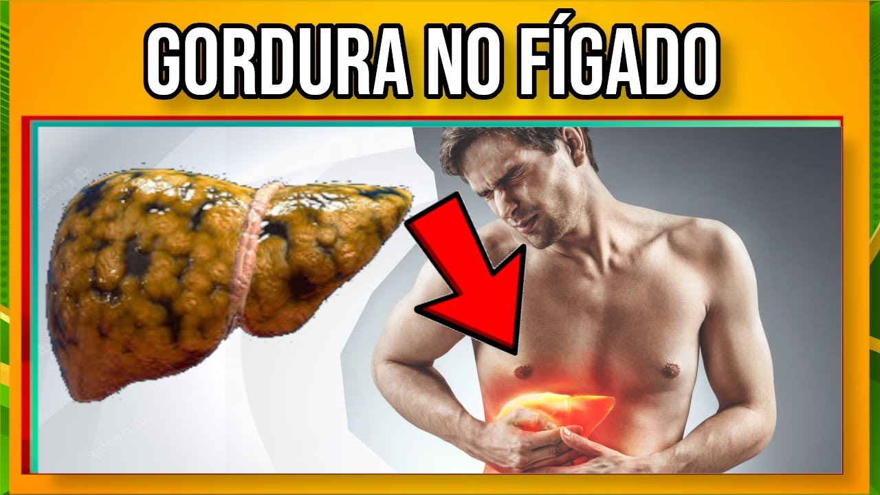 Gordura No Figado Remedio Caseiro Retoedu