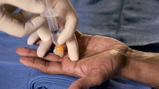 Peripheral Nerve Blocks for Hand Procedures | NEJM