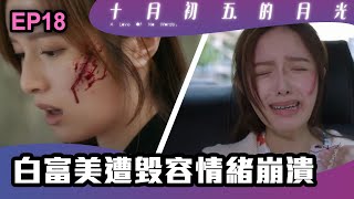 十月初五的月光 | 第18集 | 白富美遭毀容情緒崩潰