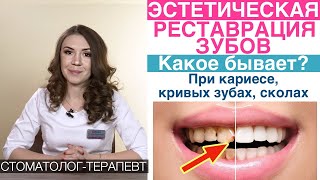 Эстетическая реставрация передних зубов, композитный (пломбировочный) материал, винирами.Кариес,щель