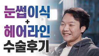 눈썹이식과 헤어라인교정을 함께한 모발이식 후기