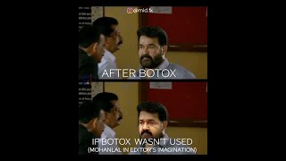 Mohanlal | with and without (Rs.10 VFX) botox look | malayalam | #midfx