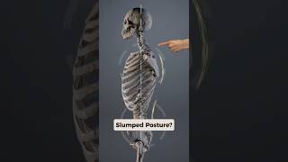 Slumped posture? Release this Fascia to stand up taller! #fascia #posture #neckpainrelief #headaches