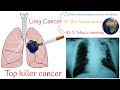 Lung cancer - Risk Factors, Symptoms, Prognosis. Types of Lung cancers