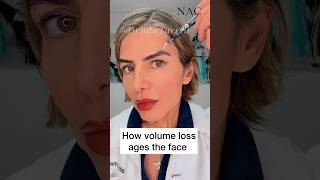 #volumeloss #antiaging #fillers #hyaluronicacid #sculptra #biostimulator #radiesse #drbitafarrell