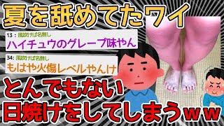 【バカ】日焼け対策なんかしないで半ズボンで半日釣りしたろ！！→なんJしてないで早く病院行けよｗｗｗｗ【2ch面白いスレ】