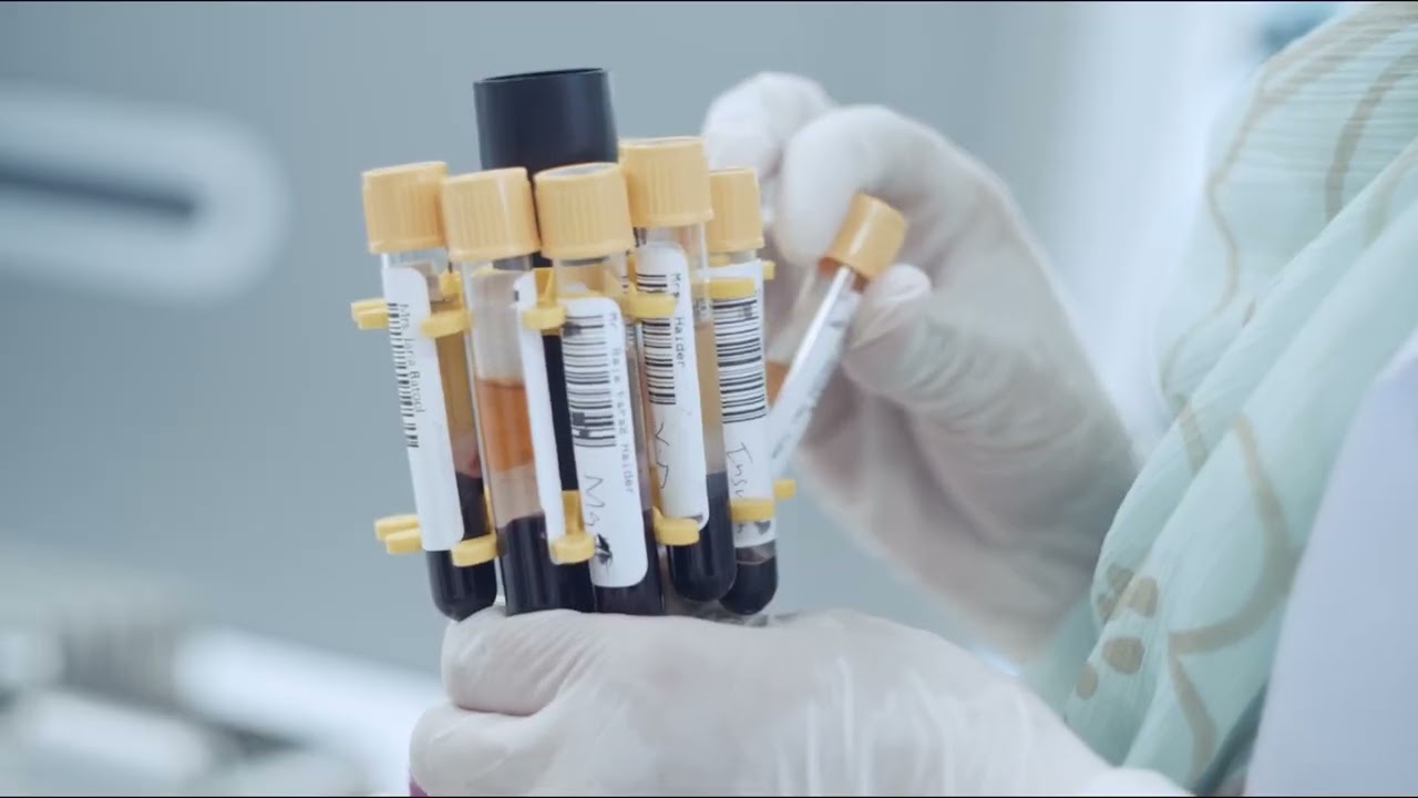 Total Lab Automation Tla Media Best Diagnostic Center Medical