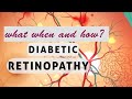 This will  change your perspective about DIABETIC RETINOPATHY!