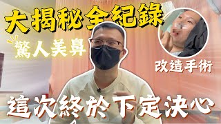 【真實紀錄】我的鼻中膈\u0026下鼻甲手術｜呼吸通透新境界｜完全改善鼻塞過敏症狀