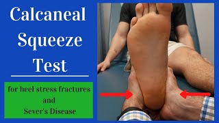 Calcaneal Squeeze Test (Heel Squeeze)