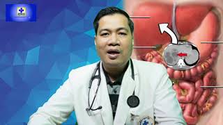 ជំងឺបូសថ្លើម-Liver Abscess