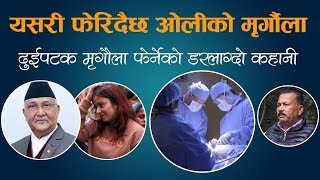 यसरी फेरिदैछ ओलीको मृगौला । दुई पटक मृगौला फेर्ने भन्छन्– आतिनु पर्दैन, म गाडी हाकेर हिड्छु