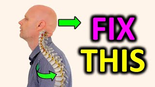 Correct Rounded Shoulders & Forward Head Posture Using One Exercise