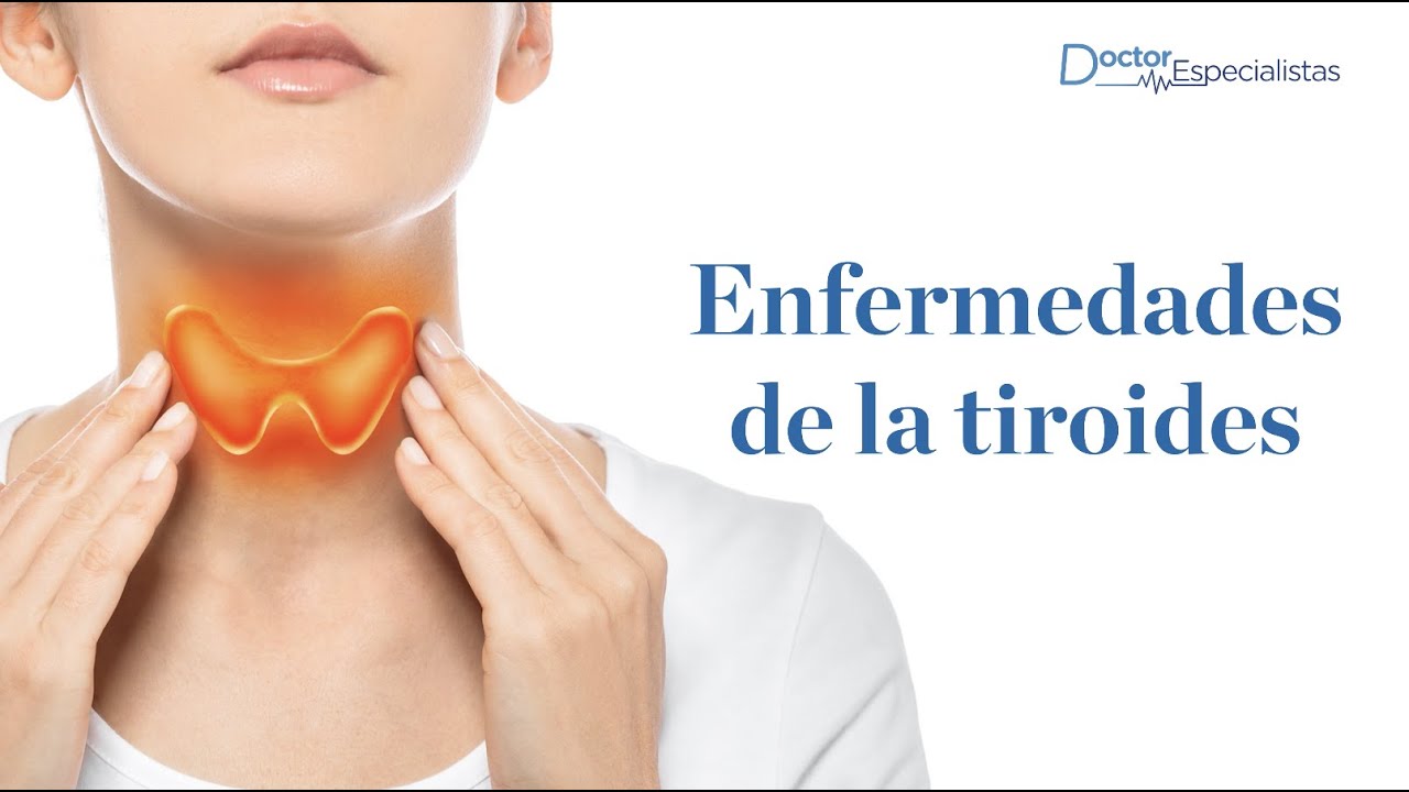 Enfermedades De La Tiroides - Doctores Especialistas - YouTube